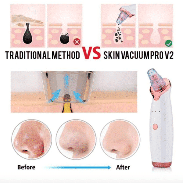 Modernmua™ Official Retailer – Skin Vacuum Pro V2