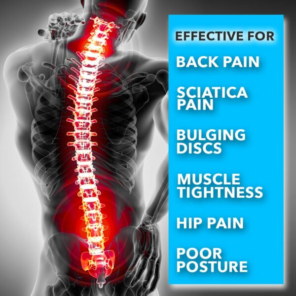 Spine Track™ Orthopedic Back Stretcher – Official Retailer