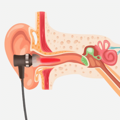 ReHears (Official Retailer) 2025