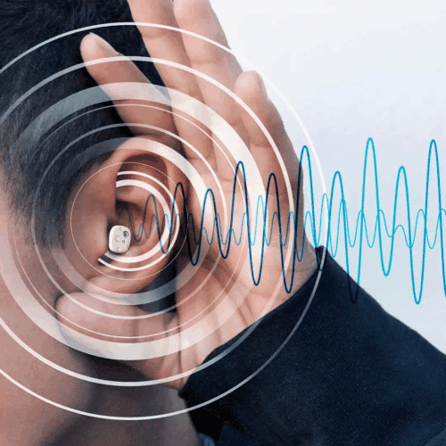 Novorito CIC Hearing Aids (Official Retailer) 2025