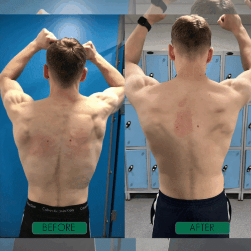 CoreCare Posture Corrector (Official Retailer) 2025