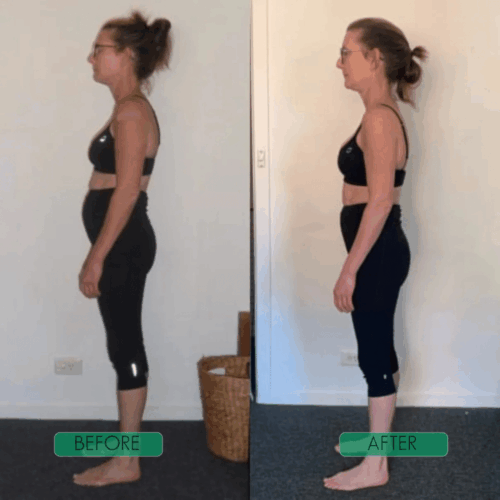 CoreCare Posture Corrector (Official Retailer) 2025