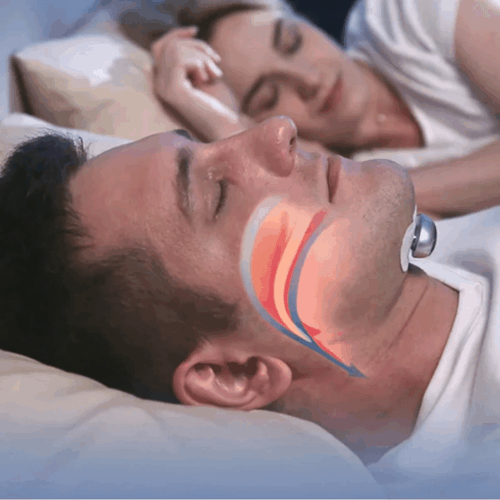 Snore Savior - Official Retailer