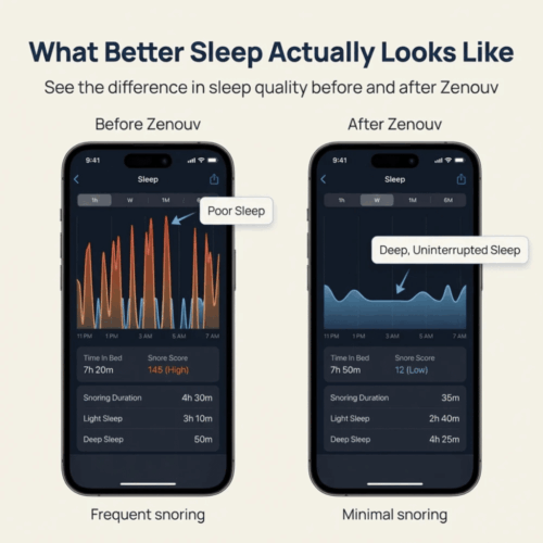 Zenouv Anti-Snoring Mouthpiece (Official Retailer) 2026