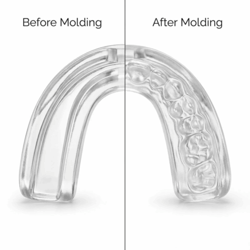 Zenouv Anti-Snoring Mouthpiece (Official Retailer) 2026