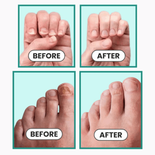 DermaBlue (Upgraded Version) - Official Retailer