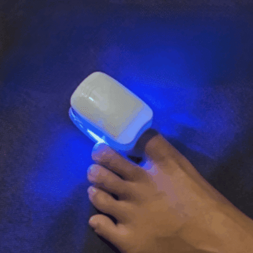 DermaBlue (Upgraded Version) - Official Retailer